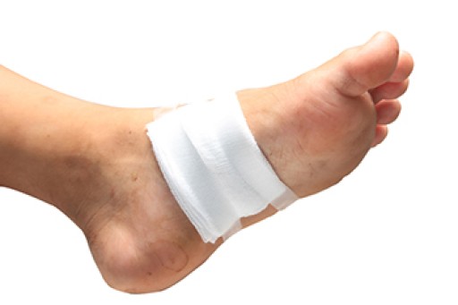 Puncture Wounds to the Foot