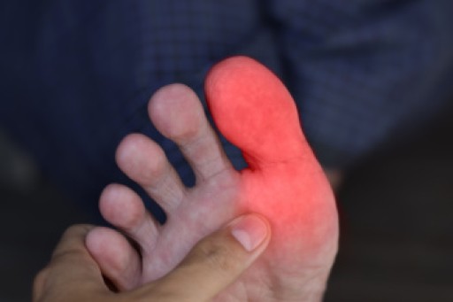 Causes of Toe Numbness and Tingling