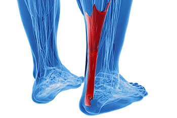 achilles tendon treatment in the Plymouth County, MA: Plymouth (Kingston, Duxbury, Marshfield, Pembroke, Hanson, Halifax, Middleborough, Carver, Bridgewater, Lakeville) areas